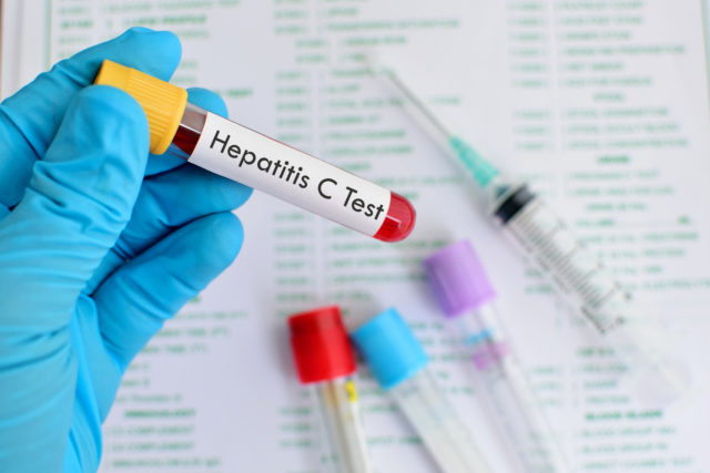 Hepatitis C testing