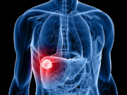 Орон нутагт 29000 иргэн элэгний в, с вирусын шинжилгээнд хамрагдав B-C-Virus