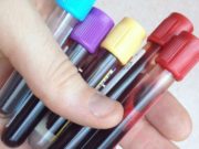 БЗД: Өрхийн эмнэлэг биохими болон цусны шинжилгээ авдаг боллоо tsusnii-shinjilgee