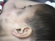 Хойд эцэгтээ зодуулсан хүүгийн амь нас эрсдэлтэй байна! hoid-etsegtee-zoduulsan-huu