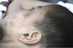 Хойд аавдаа зодуулсан хүү “ухаан орсон” гэв zoduulsan-huu